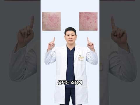 여드름 흉터 방치하면 더 심해지는 이유 (지금이 치료 골든타임입니다)